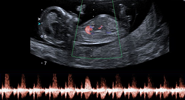 Activité cardiaque