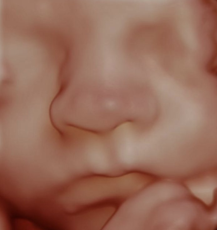 Visage 3D
